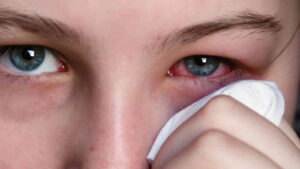 Симптомы ухудшения зрения после COVID-19