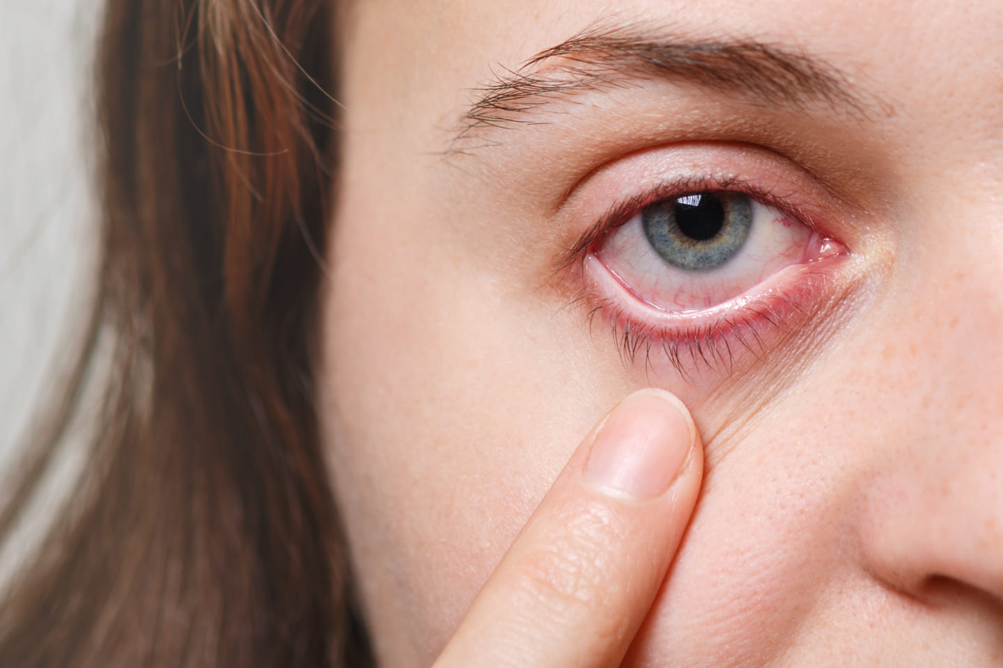 Самые распространенные заболевания глаз: виды, причины, симптомы
